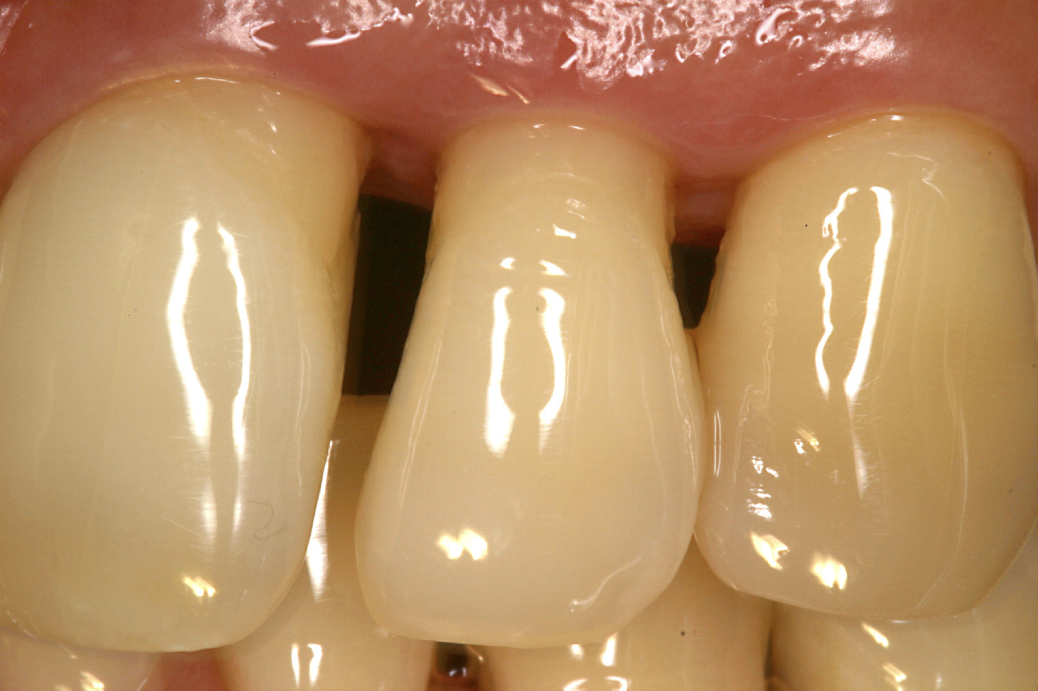 歯周病って？のイメージ